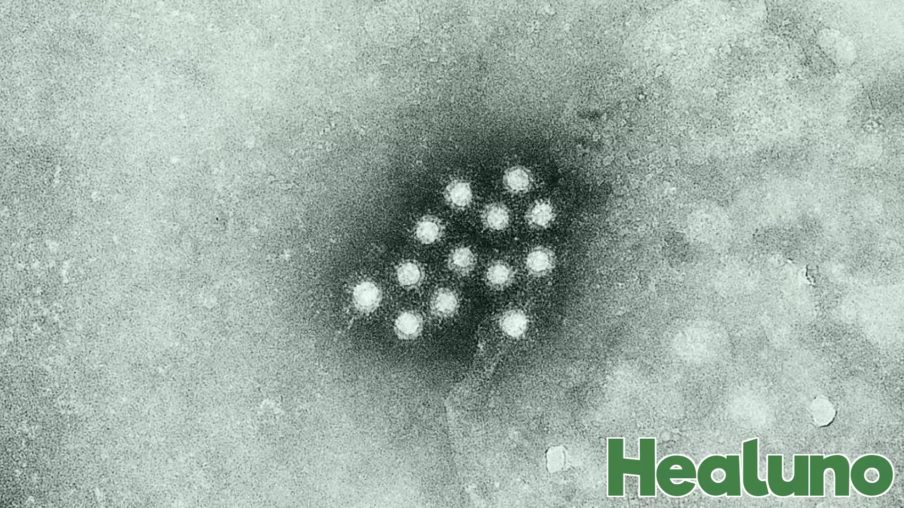 Health Officials Alert Community to Possible Hepatitis A Risk at Local Restaurant